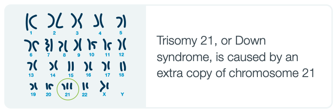 Drawings of all the chromosomes with 21 circled and the text 'Trisomy 21, or Down syndrome, is caused by an extra copy of chromosome 21.'